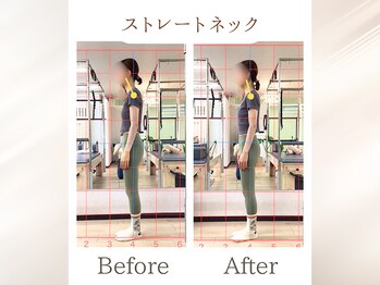 ラ ピラティス 静岡店(La pilates)/ストレートネック改善/肩こり