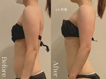 ユーフォリア グロウ(euphoria glow)/｛　ラフォス痩身90分24回　　}