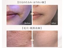 ディアユー(Dearyou)の雰囲気（フェイシャル症例一例になります。）