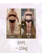 エメカシワ(Aimer KASHIWA)/50代の方　6ヶ月での変化