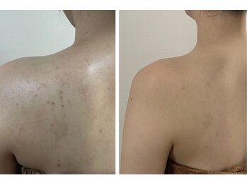 スリリアン 銀座/★お客さまビフォーアフター★