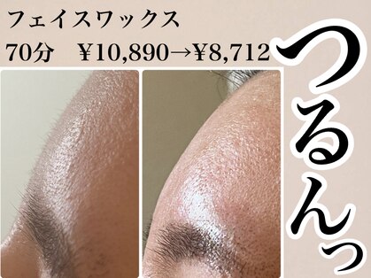 エースマイルイズ(A smile is..)の写真