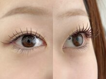 ムニ(muni)/LEDボリュームフラットmix