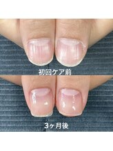 ネイルサロンアンドスクール マルベリー(mulberry)/江南市/自爪育成