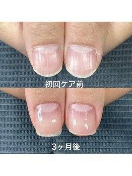 ネイルサロンアンドスクール マルベリー(mulberry)/江南市/自爪育成