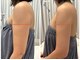 ラピスラズリの写真/自己ケアで落ちない二の腕・背中・ハミ肉…美容機器×リンパケアでしっかり細くしたい！