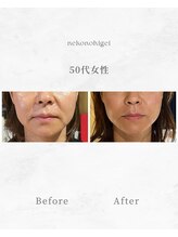 ねこのひげ/お客さんの変化