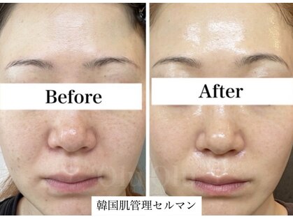 ロイヤル ビューティー サロン(Royal Beauty Saloon)の写真