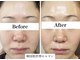 ロイヤル ビューティー サロン(Royal Beauty Saloon)の写真