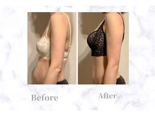 【バストアップ専門店】ふじこのきもち 溝の口〈育乳/痩身/フェイシャル〉の雰囲気(独自のマッサージ技術と施術で原因となる姿勢もしっかり改善!)