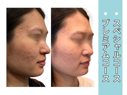 プラマイル(Pramile)の写真