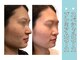 プラマイル(Pramile)の写真