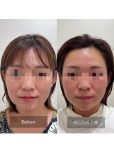 ラ クレール ビューティーサロン(LA CLAIR)/小顔リフトマシン豊富に取り揃え