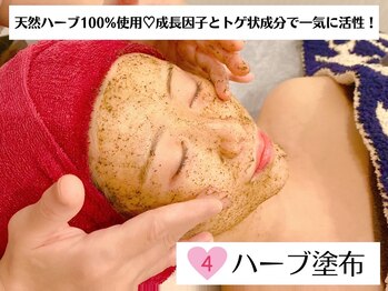 トップスキン 名駅(TOPSKIN)/手順4 ハーブピーリング塗布