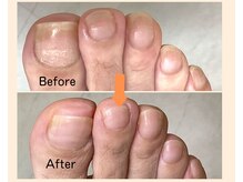 フスフレーゲ 池袋東口店/ビフォアフター写真