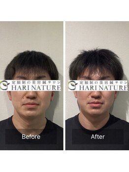 ハリナチュレ 神戸元町店/初回体験Before After