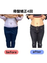 トトノエル/骨盤トトノエル