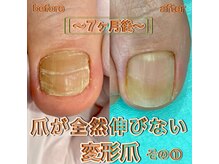 新宿巻き爪補正店/