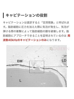 アイビークイーン(I.B.QUEEN)/自慢のキャビ40Khz
