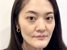 トミー(Tommy)/まつげパーマ