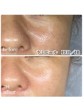 ルマエクレ(rmaecla)/お肌は育てるもの