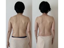 ピリリコ 白金台/痩身　ビフォーアフター　