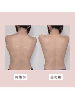 ミーティス/上半身集中のお客様♪