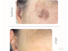 クレヴィア(cre’bia)の雰囲気(北陸初導入!!最新シミケアで諦めていた肌に革命を!!)