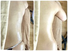 エルブラン(Herb ame)/肩こり/腰回り/くびれ/脂肪分解