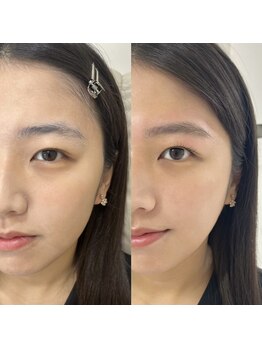 リル 目黒(Rire)/まつ毛パーマ×Wax脱毛