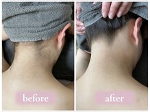 アルゴ 敦賀店(ALGO)の雰囲気（最新脱毛機種で結果重視★全身脱毛30分!）