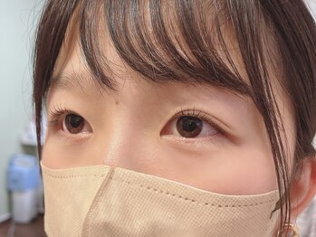 リアアイ(li`a eye)/Rush lift