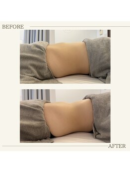 ブリッサム 恵比寿店(Blissum)/内側が変われば外側も変わる