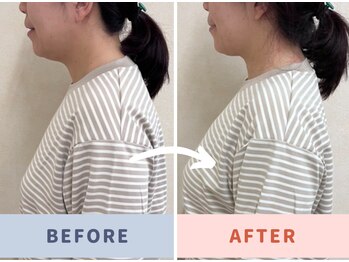 くすの木 治療院/横姿気にした方がいいかも。。。