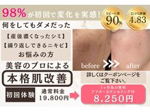 カルナ(CARNA)