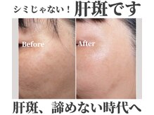レーヌ(Reine)の雰囲気（【地域唯一の施術】韓国最新肌管理マシンが底力発揮！）
