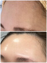 アルマサロン 菊陽(Almasalon)/【HAAB REPRO】ハーブリプロ