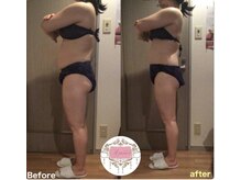 サロンアムール(salon Amour)の雰囲気(結果重視ならセル脂肪分解がおすすめ♪選べる価格帯もご好評◎)