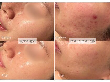 シューラディアント(ShuRadiant)の写真