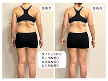 リンド(Lindo)の雰囲気（痩身★ハイパーナイフ×筋膜リリース/痩せにくい体に集中ケア）