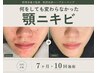 【 顎・フェイスラインニキビ改善】ハーブピーリング ¥9,900