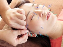 イーライフ鍼灸接骨院/美容鍼で食いしばり改善