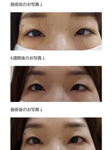 アロマスイーツ(AromaSweets)/まつげパーマ/まつ毛パーマ