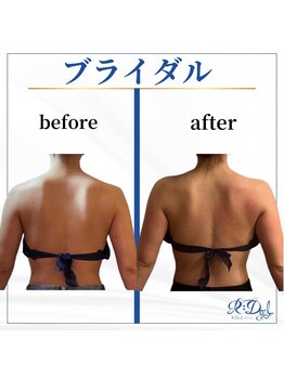 デール(R:DeeL)/ブライダルエステ