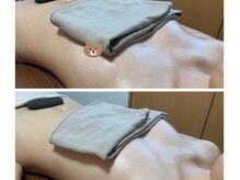 バザルトブライダル3回/時間延長あり（個人差あり）