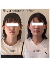 グラナダ 2F(Granada)/