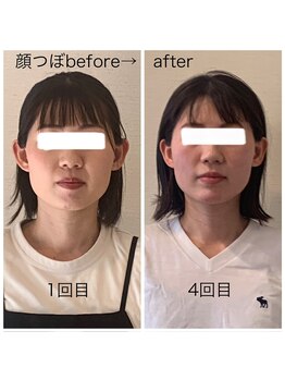 グラナダ 2F(Granada)/