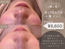ワイビューティ(Y.Beauty)