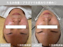 サロン ビュー(salon view)/40代女性〈たるみ悩み〉　