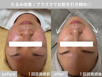 サロン ビュー(salon view)/40代女性〈たるみ悩み〉